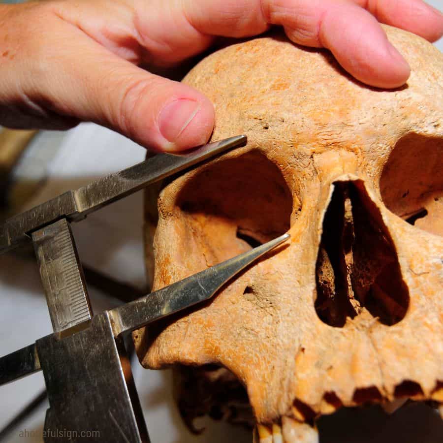 Human skull has 22 bones